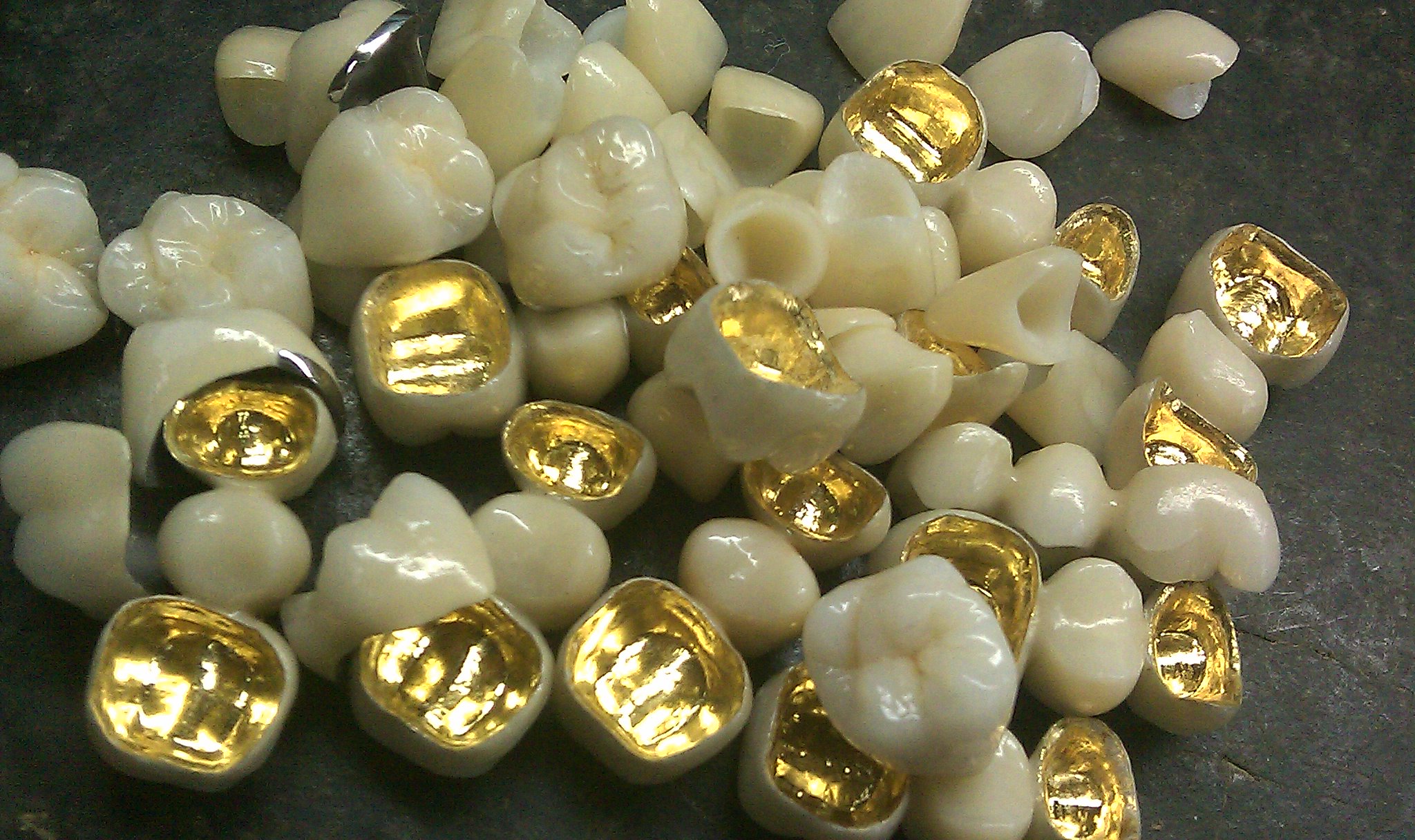 Non Precious PFM Porcelain Fused To Metal